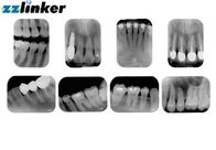 17 tamanho pequeno Intraoral dental do nível cinzento do bocado do varredor 14 da definição de Lp/Mm